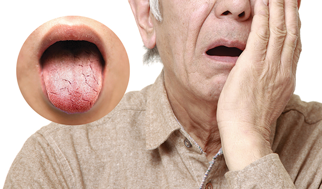 구강 건조증.jpg