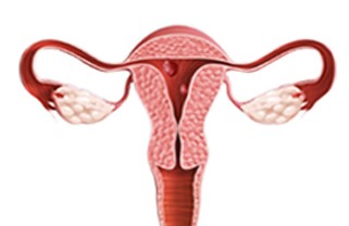 자궁내막 용종.jpg